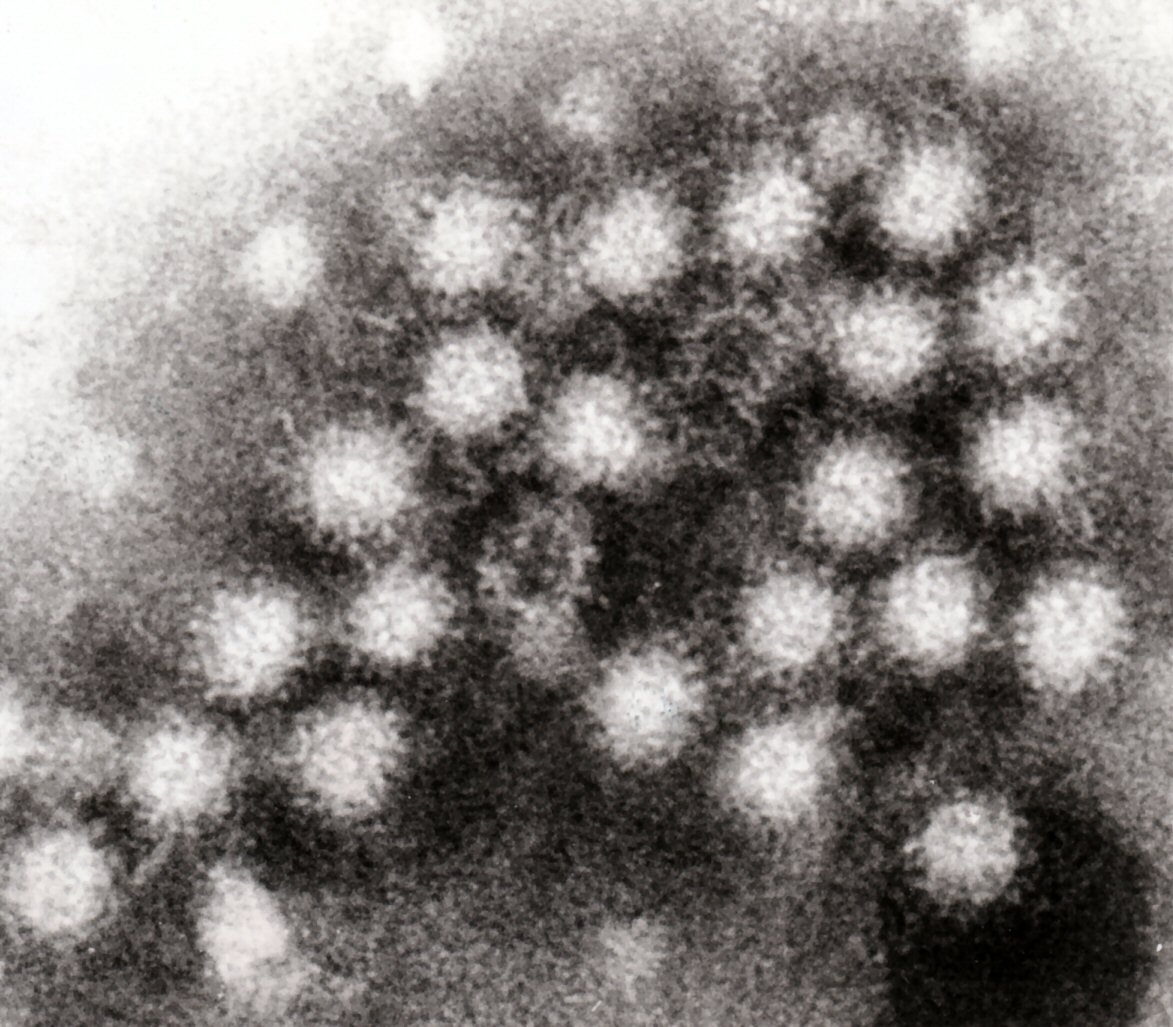 Norovirus 4 ノロウイルス流行が始まる。2013年は2012年よりも感染者は減少する見込み。