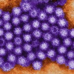 ノロウイルス流行が始まる。2013年は2012年よりも感染者は減少する見込み。