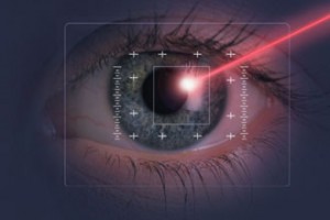 lasik eye 300x200 レーシック手術後の異変を40%の患者が訴える。消費者庁が注意喚起する事態に！