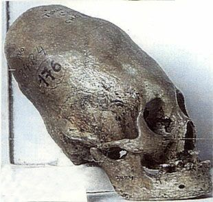 0d40a5e4a645fc6b96e767d64ac0878e1 長頭頭蓋骨、世界中で発見される謎の骨！
