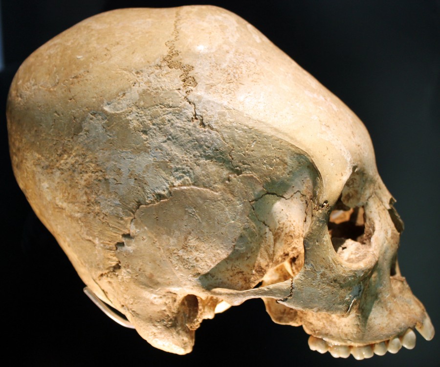 2c3490253cf4d17b4742f9705d91a264 900x752 長頭頭蓋骨、世界中で発見される謎の骨！