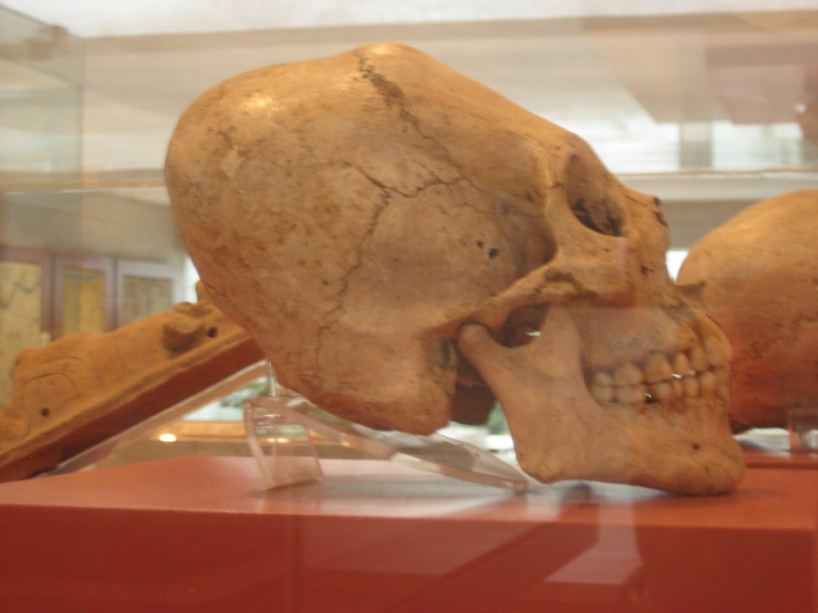 3371685342 d42a200e0d b 900x675 長頭頭蓋骨、世界中で発見される謎の骨！