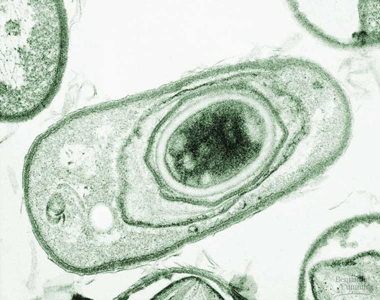 c27x10anthrax spores ボツリヌス菌、自然界最強の細菌！