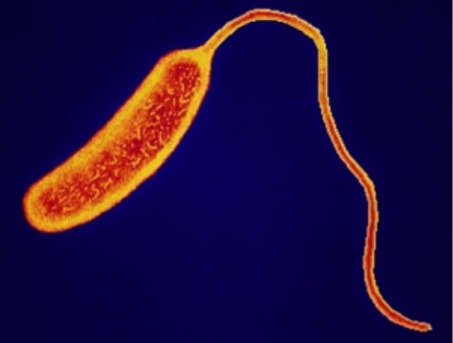  コレラがガーナで蔓延！エボラに続いて流行拡大が懸念される事態に。