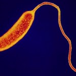 コレラがガーナで蔓延！エボラに続いて流行拡大が懸念される事態に。