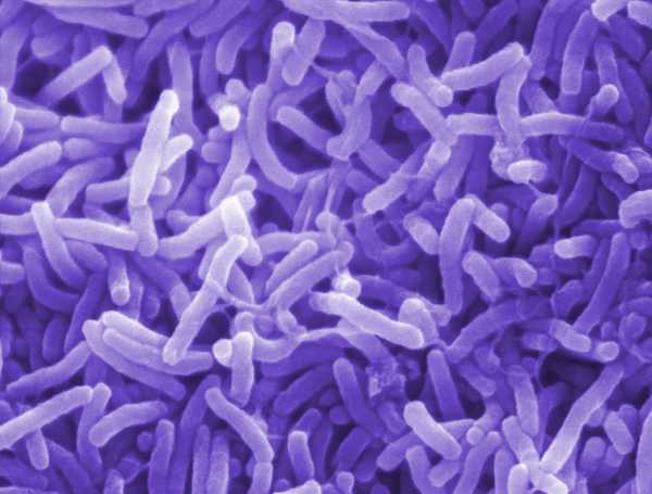cholera bacteria コレラがガーナで蔓延！エボラに続いて流行拡大が懸念される事態に。